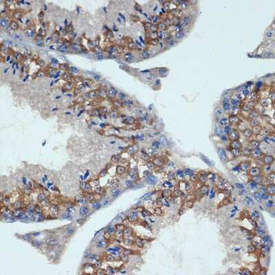 Immunohistochemistry-Paraffin: CHMP2B Antibody (3L9O5) [NBP3-15707]
