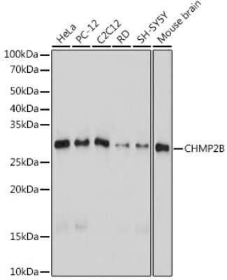 Western Blot: CHMP2B Antibody (3L9O5) [NBP3-15707]