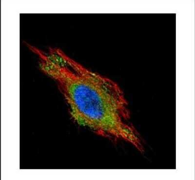 Immunocytochemistry/ Immunofluorescence: CHMP2B Antibody [NBP2-15886]
