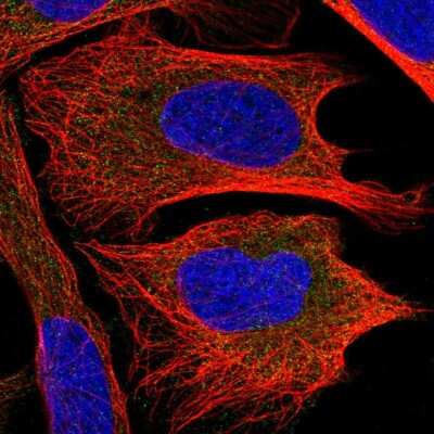 Immunocytochemistry/ Immunofluorescence: CHMP2B Antibody [NBP2-56956]