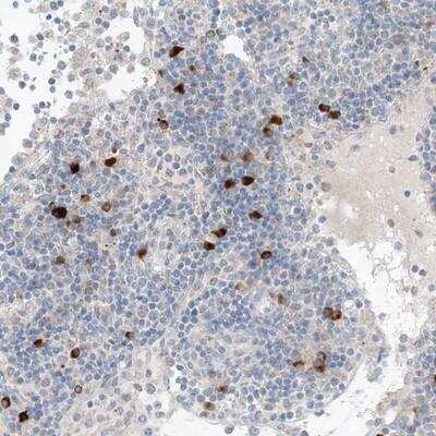 Immunohistochemistry-Paraffin: CHMP2B Antibody [NBP1-84482]