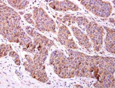 Immunohistochemistry-Paraffin: CHMP2B Antibody [NBP2-15887]