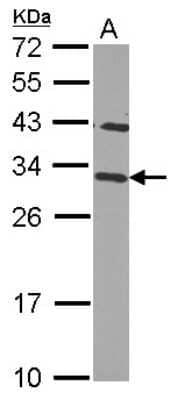 Western Blot: CHMP2B Antibody [NBP2-15886]