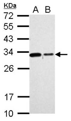 Western Blot: CHMP2B Antibody [NBP2-15887]