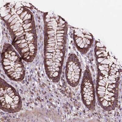 Immunohistochemistry-Paraffin: CHMP4A Antibody [NBP2-49557]