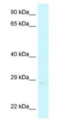 Western Blot: CHMP4A Antibody [NBP1-79920]