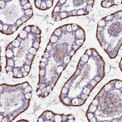 Immunohistochemistry-Paraffin: CHMP4B Antibody [NBP1-91782]