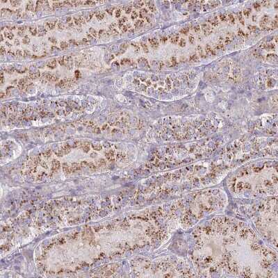 Immunohistochemistry-Paraffin: CHMP4B Antibody [NBP1-91782]