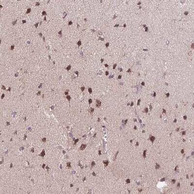 Immunohistochemistry-Paraffin: CHMP4B Antibody [NBP2-49018]