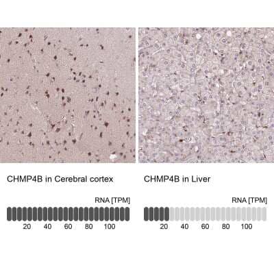 Immunohistochemistry-Paraffin: CHMP4B Antibody [NBP2-49018]