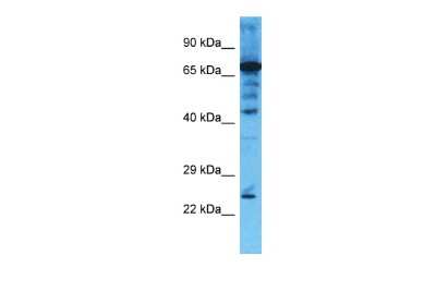 Western Blot: CHMP4B Antibody [NBP1-56995]