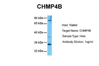 Western Blot: CHMP4B Antibody [NBP2-87183]