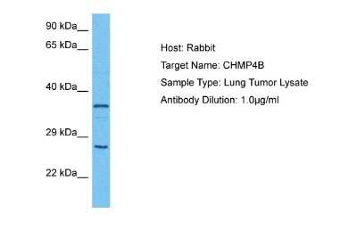 Western Blot: CHMP4B Antibody [NBP2-87183]