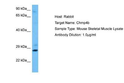 Western Blot: CHMP4B Antibody [NBP2-87184]