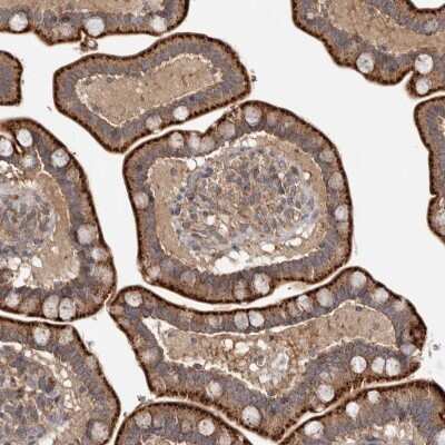 Immunohistochemistry-Paraffin: CHMP4C Antibody [NBP1-81166]