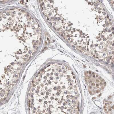 Immunohistochemistry-Paraffin: CHMP4C Antibody [NBP1-81166]