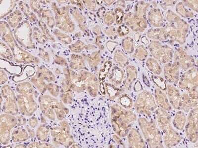 Immunohistochemistry-Paraffin: CHMP4C Antibody [NBP2-97351]