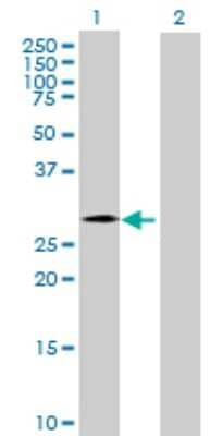 Western Blot: CHMP4C Antibody [H00092421-B01P]