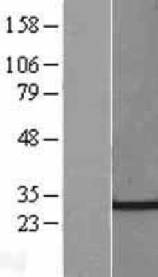 Western Blot: CHMP4C Overexpression Lysate [NBL1-09161]