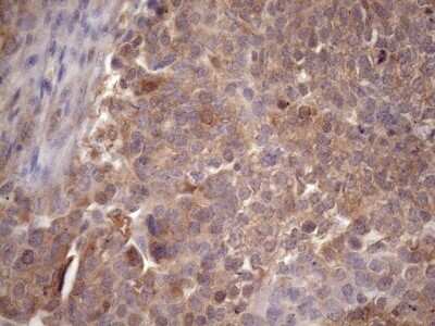 Immunohistochemistry: CHMP5 Antibody (OTI5C7) [NBP2-46283]