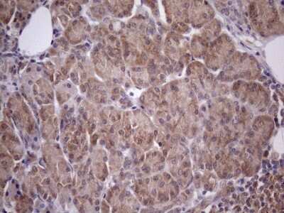 Immunohistochemistry: CHMP5 Antibody (OTI5C7) [NBP2-46283]
