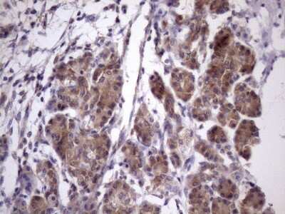 Immunohistochemistry: CHMP5 Antibody (OTI5C7) [NBP2-46283]