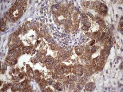 Immunohistochemistry: CHMP5 Antibody (OTI5C7) [NBP2-46283]