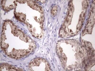 Immunohistochemistry: CHMP5 Antibody (OTI5C7) [NBP2-46283]