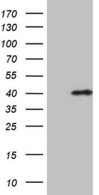 Western Blot: CHMP5 Antibody (OTI5C7) [NBP2-46283]