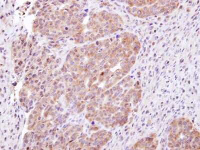 Immunohistochemistry-Paraffin: CHMP5 Antibody [NBP1-32597]