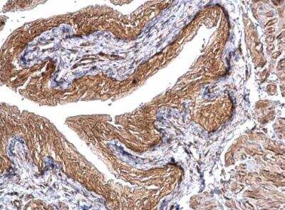 Immunohistochemistry-Paraffin: CHMP5 Antibody [NBP1-32597]