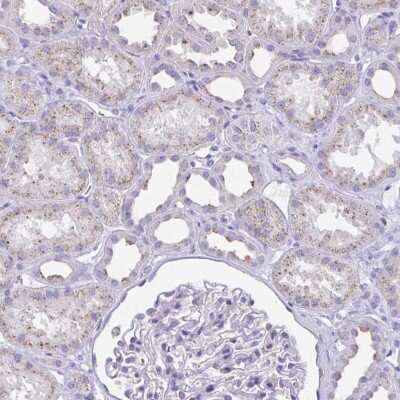 Immunohistochemistry-Paraffin: CHMP5 Antibody [NBP2-48776]