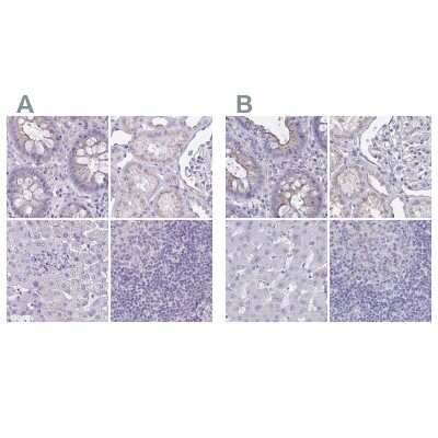 Immunohistochemistry-Paraffin: CHMP5 Antibody [NBP2-48776]