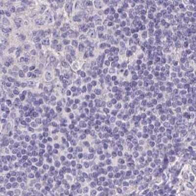 Immunohistochemistry-Paraffin: CHMP5 Antibody [NBP2-48776]