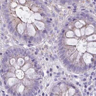 Immunohistochemistry-Paraffin: CHMP5 Antibody [NBP2-48776]