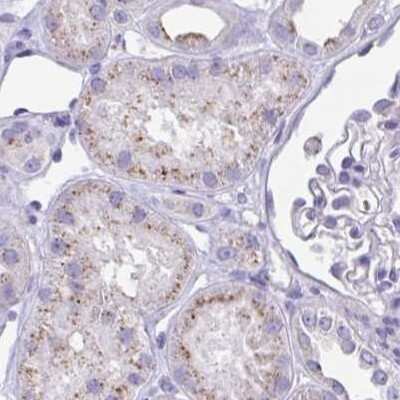 Immunohistochemistry-Paraffin: CHMP5 Antibody [NBP2-48776]