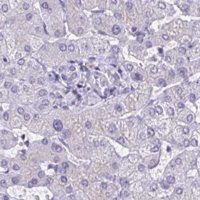 Immunohistochemistry-Paraffin: CHMP5 Antibody [NBP2-48776]