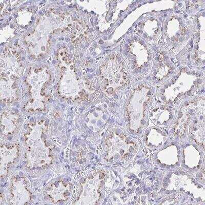 Immunohistochemistry-Paraffin: CHMP5 Antibody [NBP2-49227]