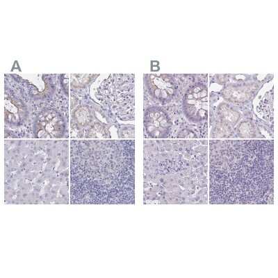 Immunohistochemistry-Paraffin: CHMP5 Antibody [NBP2-49227]