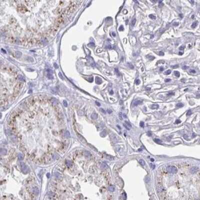 Immunohistochemistry-Paraffin: CHMP5 Antibody [NBP2-49227]