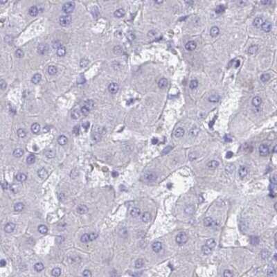 Immunohistochemistry-Paraffin: CHMP5 Antibody [NBP2-49227]