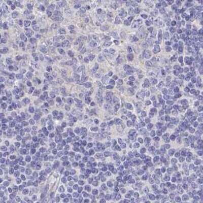 Immunohistochemistry-Paraffin: CHMP5 Antibody [NBP2-49227]