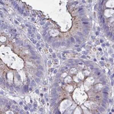 Immunohistochemistry-Paraffin: CHMP5 Antibody [NBP2-49227]