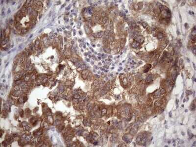 Immunohistochemistry: CHMP5 Antibody (OTI5C7) - Azide and BSA Free [NBP2-71937]