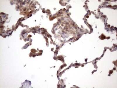 Immunohistochemistry: CHMP5 Antibody (OTI5C7) - Azide and BSA Free [NBP2-71937]