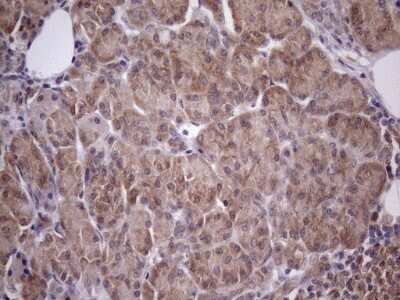 Immunohistochemistry: CHMP5 Antibody (OTI5C7) - Azide and BSA Free [NBP2-71937]
