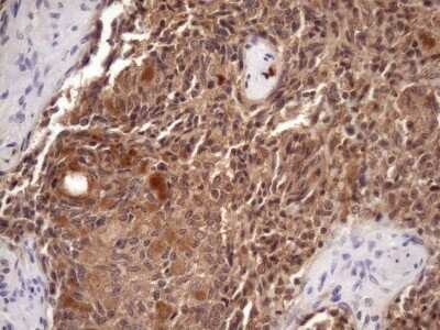 Immunohistochemistry: CHMP5 Antibody (OTI5C7) - Azide and BSA Free [NBP2-71937]