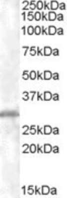 Western Blot: CHMP5 Antibody [NB100-1512]