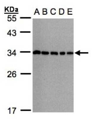 Western Blot: CHMP5 Antibody [NBP1-32597]