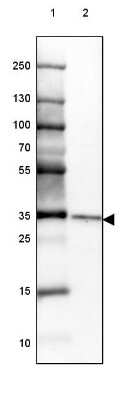 Western Blot: CHMP5 Antibody [NBP2-49227]